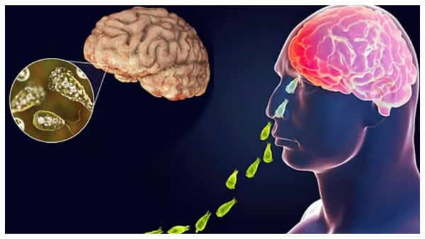 கேரளாவை மிரட்டும் மூளையை தின்னும் அமீபா.. 5 நாட்களில் 4 பேர் பலி