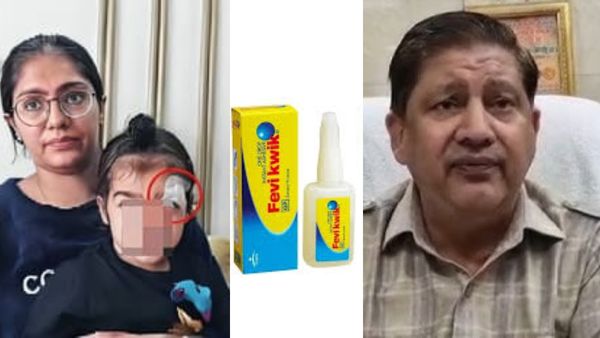 தையல் போடுவதற்கு பதில்.. சிறுவனின் காயத்தில் பெவிக்விக் ஊற்றியதாக டாக்டர் மீது புகார்