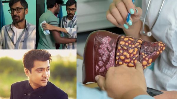 நடிகர் அபினய் உயிரைப் பறித்த கல்லீரல் சிரோசிஸ் எப்படி ஏற்படுகிறது? அதற்கான சிகிச்சை என்ன?