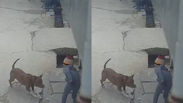 2 துண்டான காது.. ஆக்ரோஷமாக 6 வயது சிறுவனை தாக்கிய பிட்புல் நாய்.. துடிதுடித்த சிறுவன்