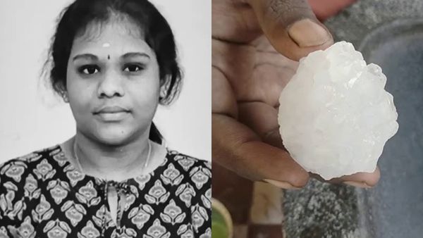 Vengaram: எடையை குறைக்க வெங்காரம் சாப்பிட்ட மதுரை கல்லூரி மாணவி பலியானது எப்படி? மருத்துவர் விளக்கம்