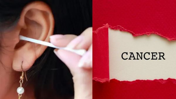 அட.. காது அழுக்கில்தான் உயிர் ஒளிந்திருக்காம்! புற்றுநோயை முன்கூட்டியே கண்டுபிடிக்கலாம்: விஞ்ஞானிகள்