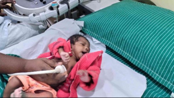 இருதயக் கோளாறால் உயிருக்கு போராடும் பச்சிளம் குழந்தை.. உயிர் காக்க உதவி செய்யுங்கள்.. ப்ளீஸ்