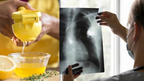Lemon Juice: குளிர்காலத்தில் எலுமிச்சை ஜூஸ் குடித்தால் நிமோனியா ஏற்படுமா?