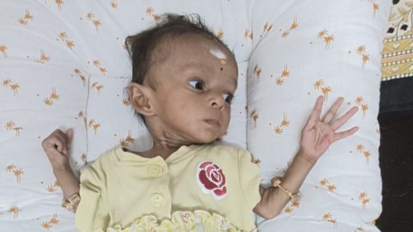 பிறந்து 2 மாதமே ஆன பச்சிளம் பெண் குழந்தைக்கு இருதய பாதிப்பு.. உயிரை காப்பாற்ற உதவுங்கள்.. ப்ளீஸ்