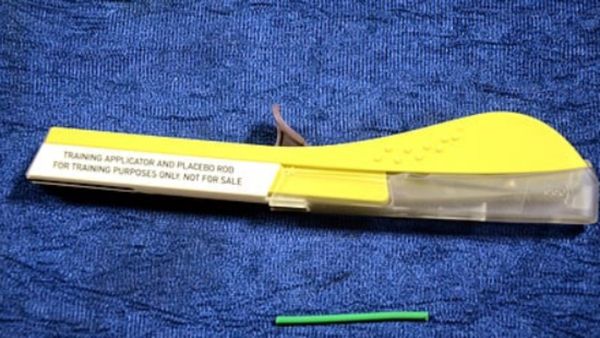 குட் பை காப்பர் டி: மதுரை அரசு மருத்துவமனையில் பெண்களுக்கு சூப்பர் 'மேஜிக் குச்சி'! 3 வருஷம் நோ கவலை