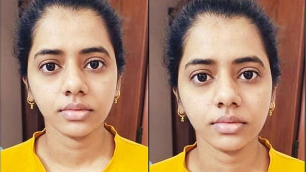 பாப்பா எப்படி இருக்கா? தந்தை கேட்டதுமே கண்கலங்கிய டாக்டர்கள்.. ஆஸ்பத்திரியில் நடந்த அந்த அதிசயம்