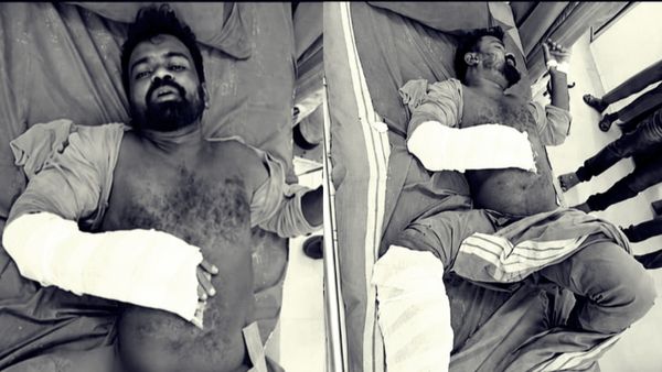 Coimbatore Girl: கோவை சிறுமி கொலை வழக்கு.. முக்கிய குற்றவாளிகளுக்கு மாவுக்கட்டு ட்ரீட்மென்ட்