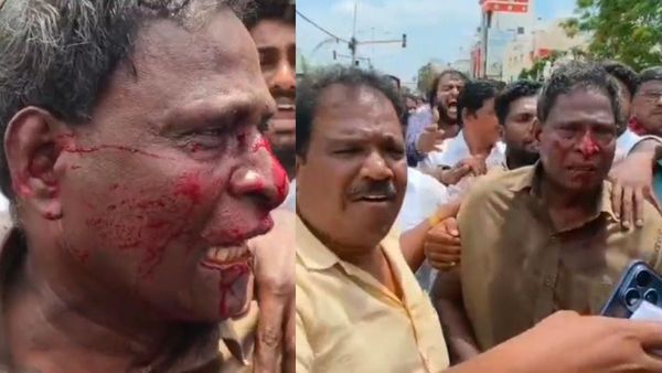 திமுக தொண்டரை ரத்தம் சொட்ட சொட்ட அடித்த போலீஸ்.. உதயநிதி கைதின்போது நடந்த சம்பவம்
