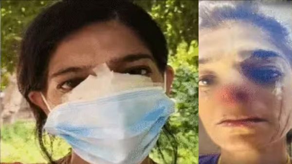 மோனிகாவின் மூக்கை கடித்த நபர்.. மூக்குத்தியையும் தூக்கிட்டு ஓட்டம்! காரணம் கேட்டால் ஆடிப்போயிருவீங்க