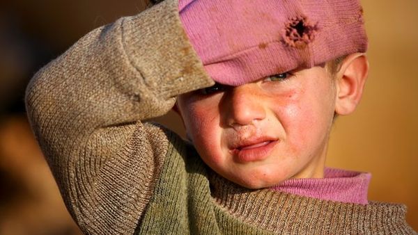 சிரியா போரில் இதுவரை 650க்கும் மேற்பட்ட குழந்தைகள் பலி: ஐ.நா.