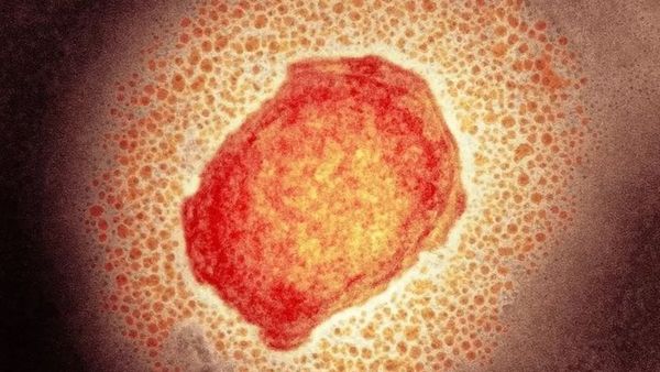 குரங்கம்மை: உடலுறவு மூலம் பரவுமா? - உலக சுகாதார நிறுவனம் எச்சரிக்கை