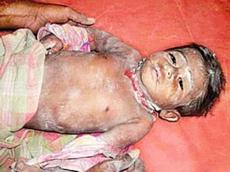 బోరు బావి నుంచి ప్రాణాలతో బయటపడిన బాలుడు
