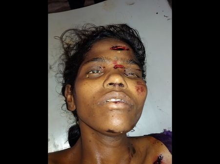  ఫొటో: హైదరాబాదులో 'నిర్భయ', రేప్ చేసి హత్య
