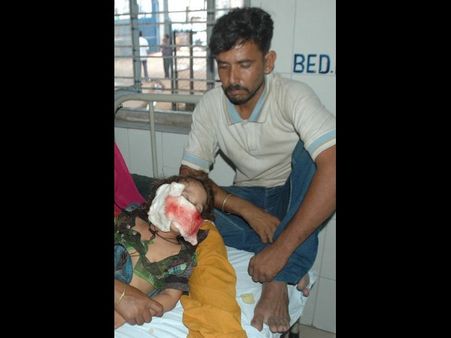 చిన్నారిని కరిచిన కుక్క: వ్యాక్సిన్ రియాక్షన్ (ఫోటోలు)