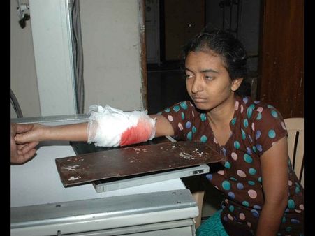  డ్రైవర్‌కు తగ్గిన బిపి: ఆటోను ఢీకొట్టిన కారు (పిక్చర్స్)