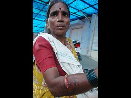 పిచ్చి పిచ్చిగా కరుస్తున్న కుక్కలు (పిక్చర్స్)