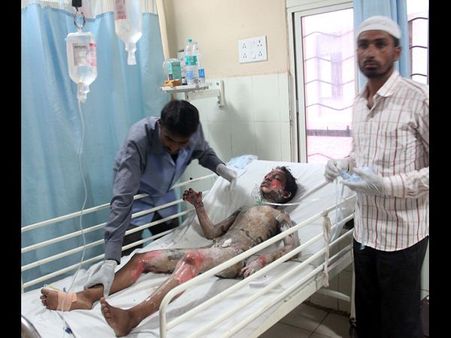 కిరోసిన్ పోసి నిప్పంటించిన బాలుడు మృతి(ఫోటోలు)