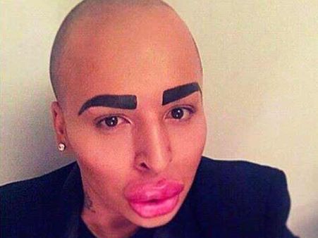 కర్దాషియన్‌లా కన్పించాలని 150,000 డాలర్లు ఖర్చు పెట్టాడు