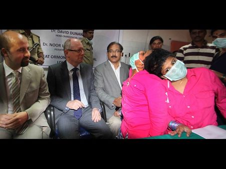 అవిభక్త కవలలు వీణావాణీలకు శుభవార్త: లండన్‌లో ఆపరేషన్