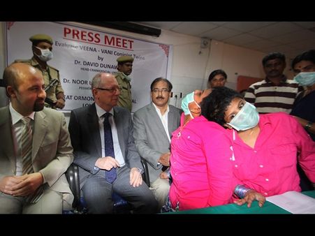 అవిభక్త కవలలు వీణావాణీలను వేరు చేస్తాం: లండన్ వైద్యులు