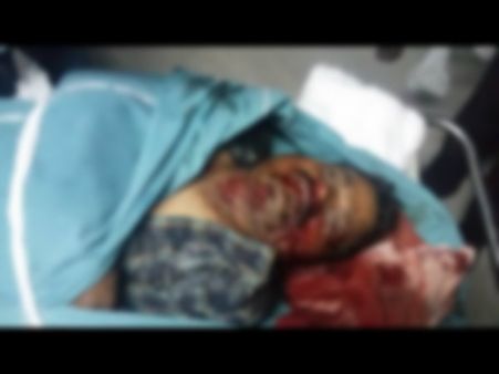 కారు ప్రమాదం: 'పెళ్లి పుస్తకం' నిర్మాత నాగిరెడ్డి దుర్మరణం