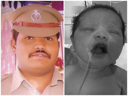 సిద్ధయ్య కుమారుడి గుండెలో రంధ్రం, రెయిన్ బో వైద్యుల ఆపరేషన్ సక్సెస్