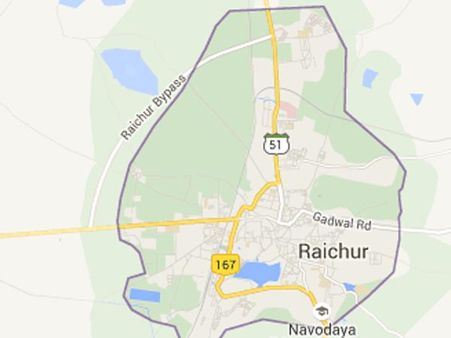 అది పొట్టా.. గల్లాపెట్టా?: వ్యక్తి కడుపులోంచి 170 నాణేలు తీశారు