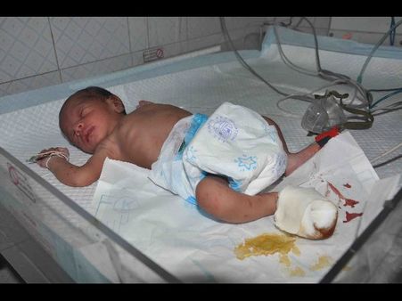 మురుగు కాలువలో పసికందు, కరచిన పందికొక్కులు: ఆస్పత్రిలో చేర్పించారు(ఫొటోలు)