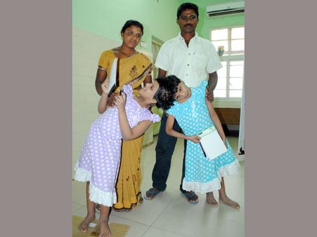 విడదీయడం అంత తేలిక కాదు, ఎన్ని రోజులని చెప్పలేం: వీణావాణీలపై వైద్యులు(పిక్చర్స్)