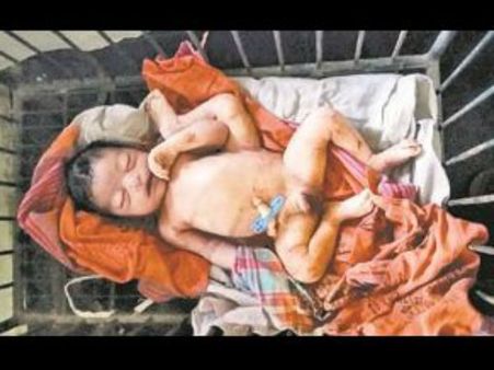 కృష్ణా జిల్లాలో వింత శిశువు జననం: చూసేందుకు ఎగబడ్డ జనం