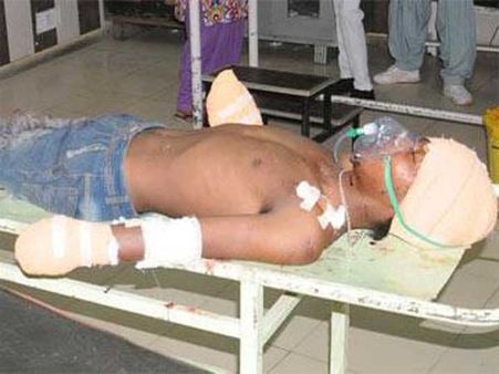 కూతురుపై రేప్: నిందితుడి చేతులు నరికేశాడు