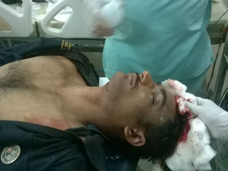 ఏకే 47 మిస్‌ఫైర్: తల భాగం నుంచి దూసుకెళ్లిన తూటా, ఆక్టోపస్ కానిస్టేబుల్ మృతి