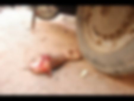 సిలిండర్ పేలి చిన్నారి మృతి: అల్లంత దూరం తెగిపడ్డ చేయి (ఫోటోలు)