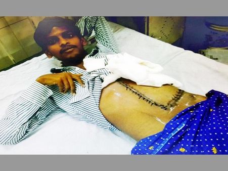 300/120: ఆపరేషన్ సక్సెస్, చరిత్ర సృష్టించిన ఉస్మానియా వైద్యులు