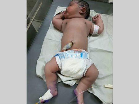 ఆశ్చర్యం: నీలోఫర్‌ ఆస్పత్రిలో 6 కిలోల బరువున్న శిశువు జననం