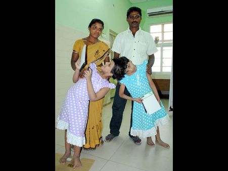 వీణా-వాణీల శస్త్రచికిత్సకు ఆస్ట్రేలియా వైద్య బృందం సుముఖత