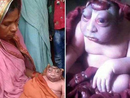 ‘‘ఈ వింత ఆకారాన్ని చూసి తల్లిగా నేను తట్టుకోలేకపోతున్నా..’’