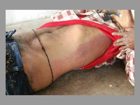 మంథని మధుకర్‌ మృతదేహానికి రీపోస్టుమార్టమ్: ముమ్మాటికీ హత్యేనంటున్న తల్లి..