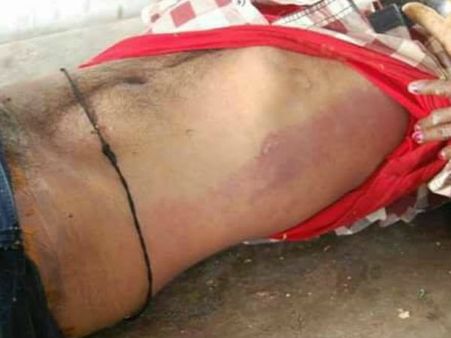 మంథని మధుకర్‌ది హత్యా? ఆత్మహత్యా: నిగ్గు తేల్చనున్న రీపోస్టుమార్టమ్!