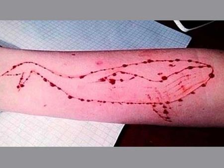 బ్లూ వేల్ గేమ్: గేమ్ పేరుతో రెచ్చగొడుతోంది, నగ్నచిత్రాలను తీయిస్తోంది, చంపేస్తోంది