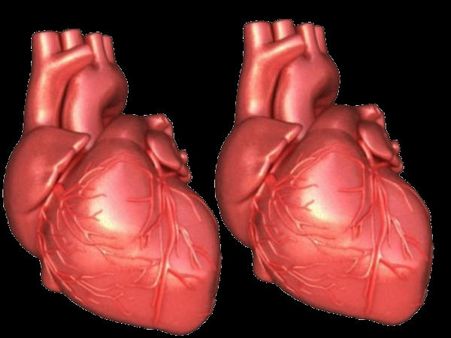 ఇది నిజం: అతడు రెండు గుండెలతో జీవిస్తున్నాడు!