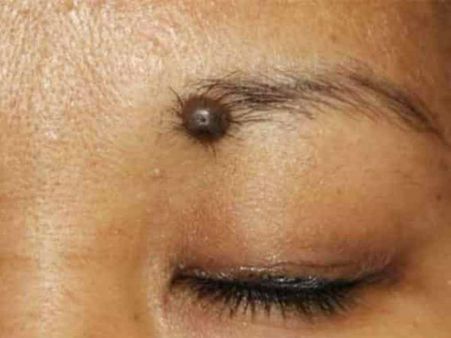 కనుబొమ్మలపై పుట్టుమచ్చలు.. వాటి ఎఫెక్ట్?
