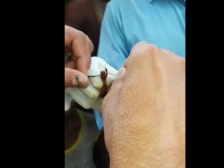 మహిళల జుట్టు కత్తిరింపు మిస్టరీ వీడింది?: ఈ పురుగే(వీడియో)