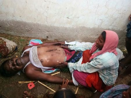 పిడుగు పడి భర్త మృతి....భార్యకు తీవ్రగాయాలు