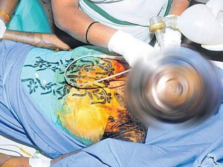 మాధురి కన్నుమూత: వరంగల్ 'యాసిడ్' ఘటనలో ట్విస్ట్.. దాడి వెనుక కారణాలివే?