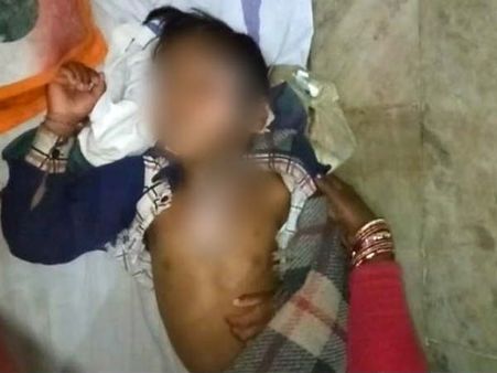 ఒకటో తరగతి విద్యార్థిపై వేడి వేడి పప్పు విసిరిన వంట మనిషి