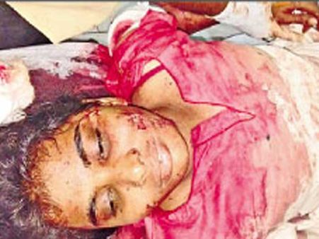 వివాహేతర సంబంధం: ప్రియురాలిపై కత్తితో దాడి...తాను కూడా పొడుచుకున్న ప్రియుడు