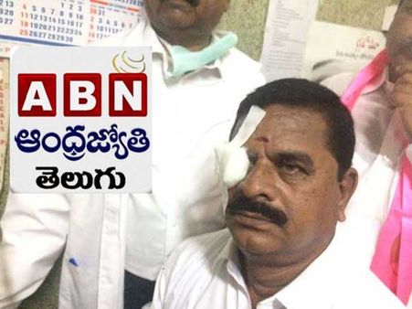 ఇక ఆపండి.. 'స్వామి గౌడ్' విషయంలో మాది పొరపాటే: ఏబీఎన్