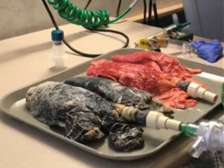 ఇది చూశాక కూడా సిగరెట్ వెలిగిస్తారా?: స్మోకింగ్ వర్సెస్ నాన్ స్మోకింగ్(వీడియో)